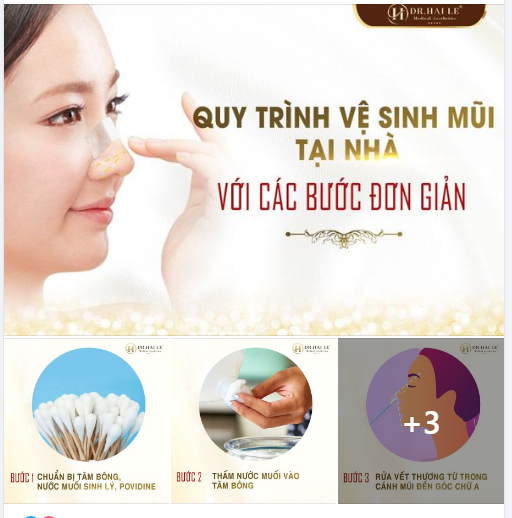 VỆ SINH VẾT THƯƠNG SAU KHI NÂNG MŨI TẠI NHÀ VỚI CÁC BƯỚC CỰC ĐƠN GIẢN!