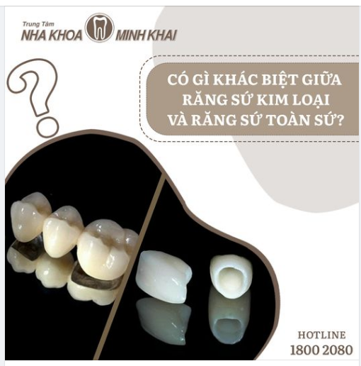 Có gì khác biệt giữa răng sứ kim loại và răng sứ toàn sứ?