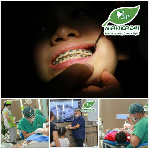 Cuối tuần rồi quý phụ huynh và các em nhỏ đừng quên ghé Nha Khoa 24H để thăm khám và kiểm tra sức khỏe răng miệng định kỳ để có một hàm răng chắc khỏe và nụ cười thật tươi đẹp nhé!