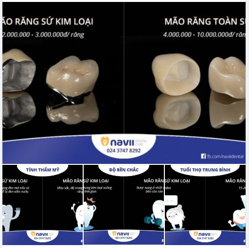 Phương pháp phục hình răng bằng mão sứ từ lâu đã rất phổ biến trong nha khoa, vừa để phục vụ mục đích thẩm mỹ, vừa để khôi phục khả năng ăn nhai
