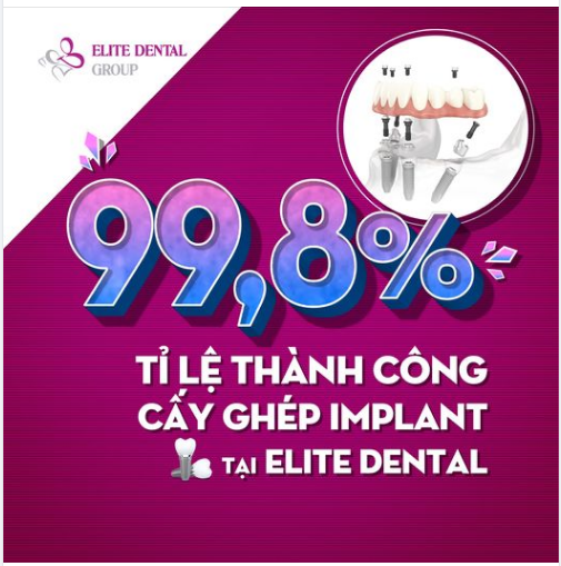 An tâm tuyệt đối khi điều trị phục hồi mất răng toàn hàm tại nha khoa Elite với tỉ lệ thành công lên đến 99,8%