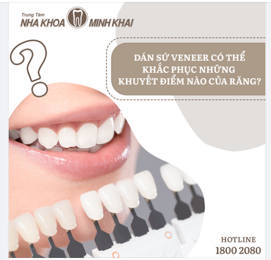 Dán sứ Veneer có thể khắc phục những khuyết điểm nào của răng?