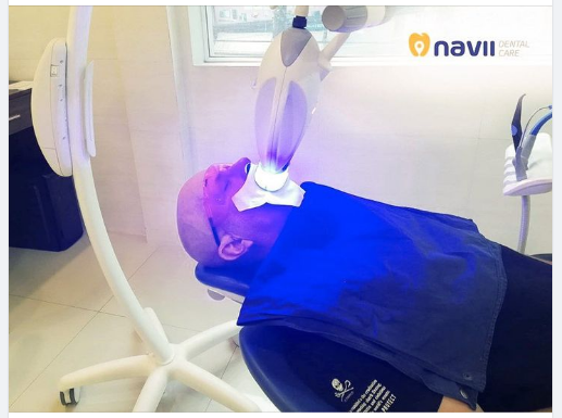 Tẩy trắng răng làm hại men răng? Chiếu đèn laser lâu sẽ gây tổn thương lợi? Ê buốt răng sau khi tẩy trắng liệu có bất thường không?