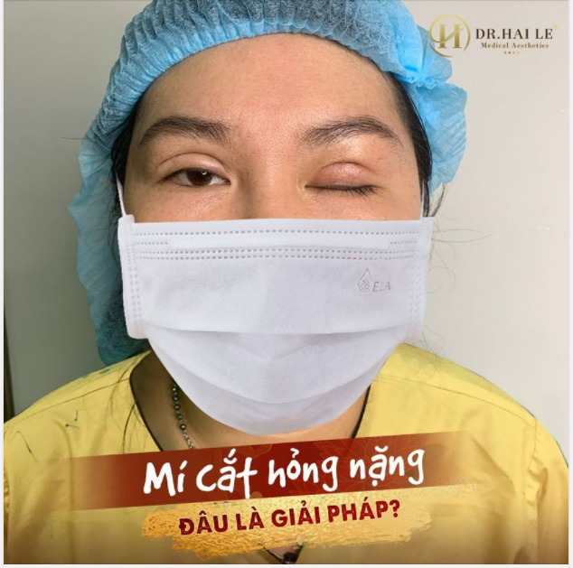 Bạn ấy đã khóc khi được người nhà đem tới Dr.Hải Lê để giải cứu mí hỏng