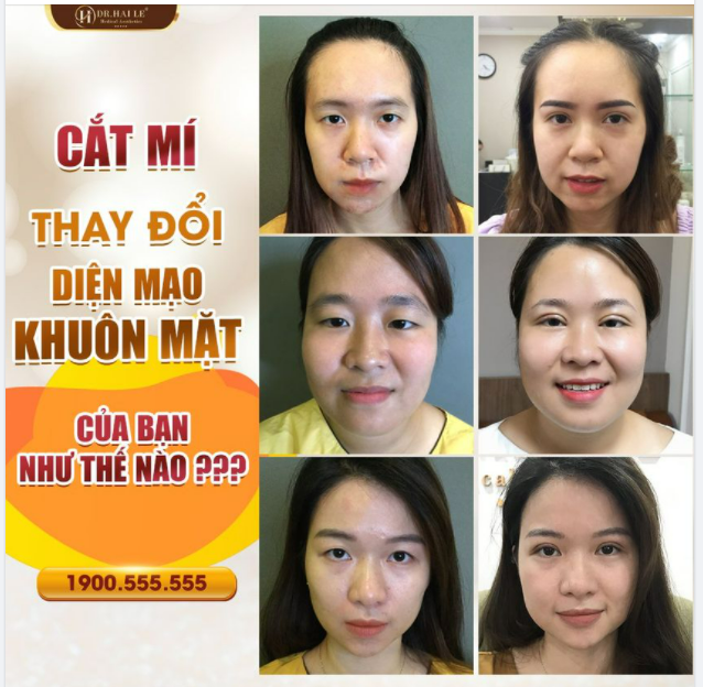 MẮT ĐẸP - MẶT SANG – THĂNG HẠNG NHAN SẮC