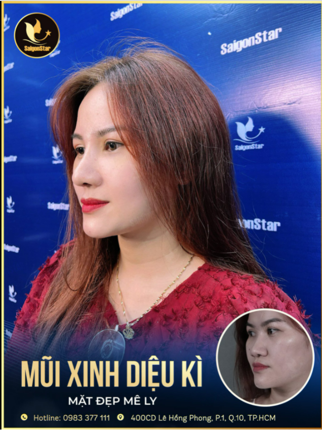 MŨI XINH DIỆU KÌ - MẶT ĐẸP MÊ LY