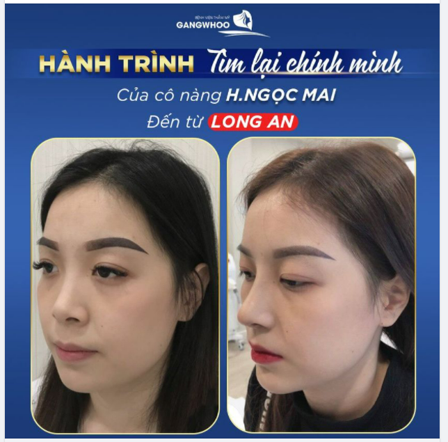 PHẪU THUẬT THẨM MỸ KHÔNG CHỈ ĐỂ ĐẸP, MÀ CHÍNH LÀ CÁCH YÊU THƯƠNG BẢN THÂN