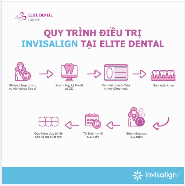 Quy trình niềng răng trong suốt với Invisalign cho nụ cười rạng rỡ