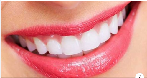 Tẩy trắng răng có làm hỏng men răng không