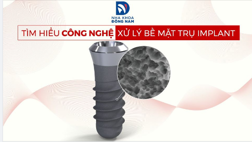 TÌM HIỂU CÔNG NGHỆ XỬ LÝ BỀ MẶT TRỤ IMPLANT
