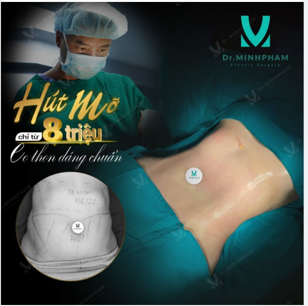 1 GIỜ GẶP DR.MINH BẰNG 1000 GIỜ TẬP GYM!!!