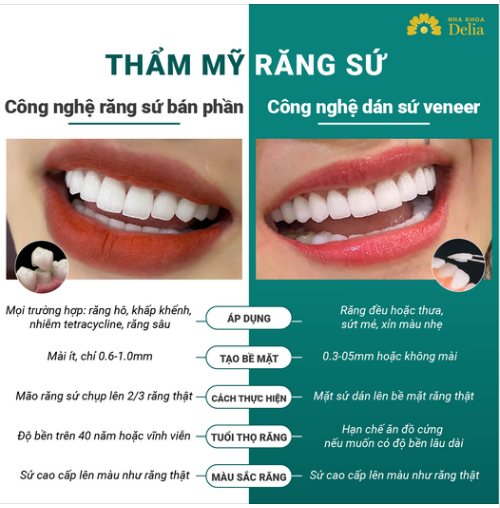 2 công nghệ răng sứ hiện đại được ưa chuộng nhất tại Delia: