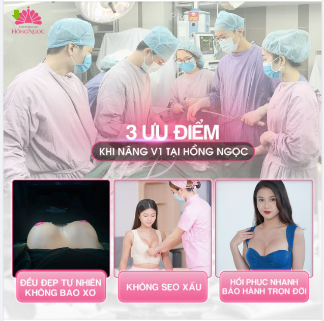 3 ƯU ĐIỂM KHI NÂNG V1 TẠI HỒNG NGỌC