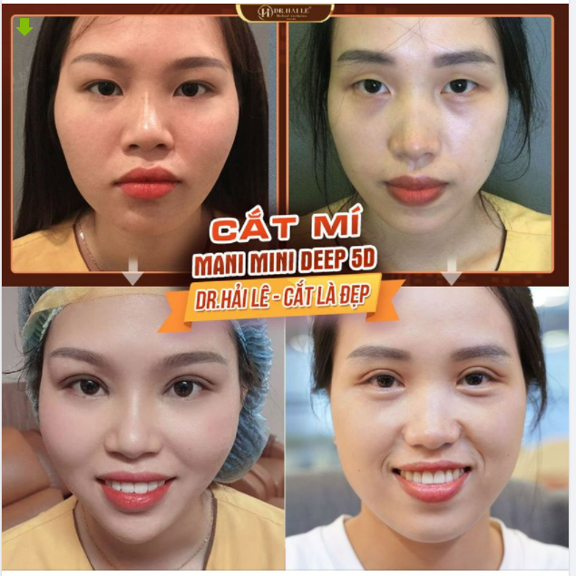 30 PHÚT THẨM MỸ CHO ĐÔI MẮT ĐẸP - NỤ CƯỜI DUYÊN