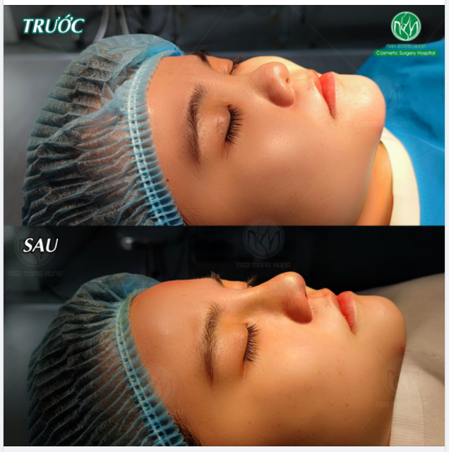 30 PHÚT THAY DÁNG MŨI - ĐẸP TỰ NHIÊN, RẠNG NGỜI