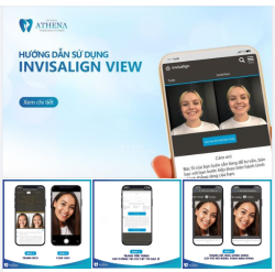 4 BƯỚC SỬ DỤNG CÔNG NGHỆ BIẾT TRƯỚC NỤ CƯỜI SAU NIỀNG RĂNG SMILE VIEW