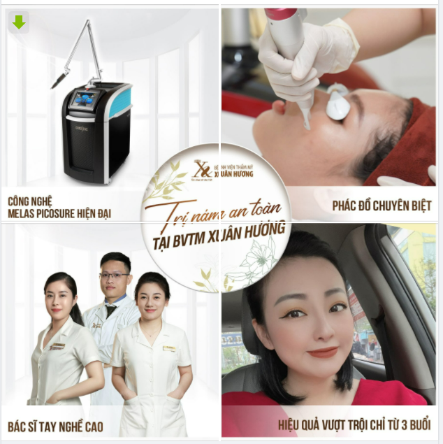 4 LÝ DO TRỊ NÁM TẠI XUÂN HƯƠNG HIỆU QUẢ NHANH CHÓNG VÀ AN TOÀN HƠN