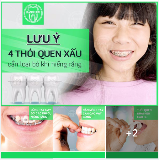 4 thói quen xấu cần bỏ khi niềng răng để đạt được hiệu quả chỉnh nha như ý!