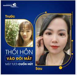 45 PHÚT BẤM MÍ - THỔI HỒN VÀO ĐÔI MẮT CỦA BẠN