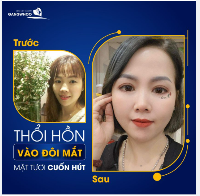 45 PHÚT BẤM MÍ - THỔI HỒN VÀO ĐÔI MẮT CỦA BẠN