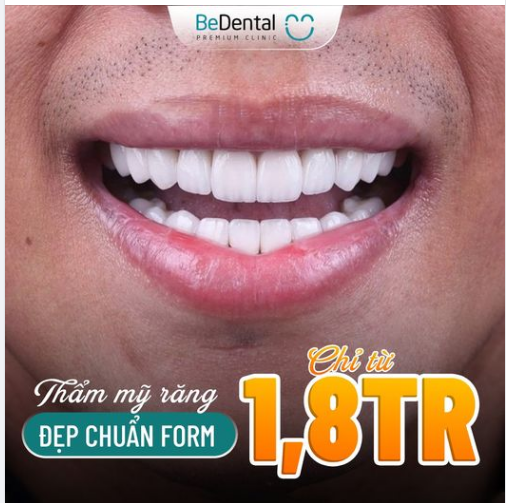 ️ 48H sở hữu hàm răng Trắng sáng - Đều đẹp - Chắc khỏe
