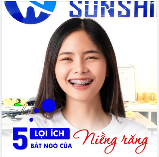 5 LỢI ÍCH BẤT NGỜ NHỜ NIỀNG RĂNG