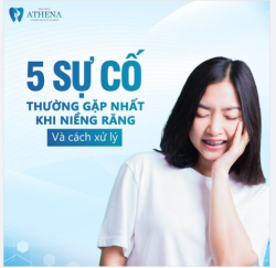 5 SỰ CỐ NIỀNG RĂNG THƯỜNG GẶP NHẤT VÀ CÁCH KHẮC PHỤC TẠI NHÀ!