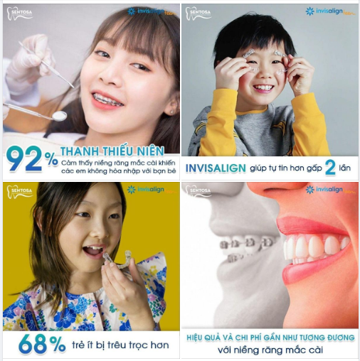  5 SỰ THẬT KHIẾN BẠN NHẬN RA INVISALIGN LÀ SỰ LỰA CHỌN HOÀN HẢO Ở TUỔI TEEN