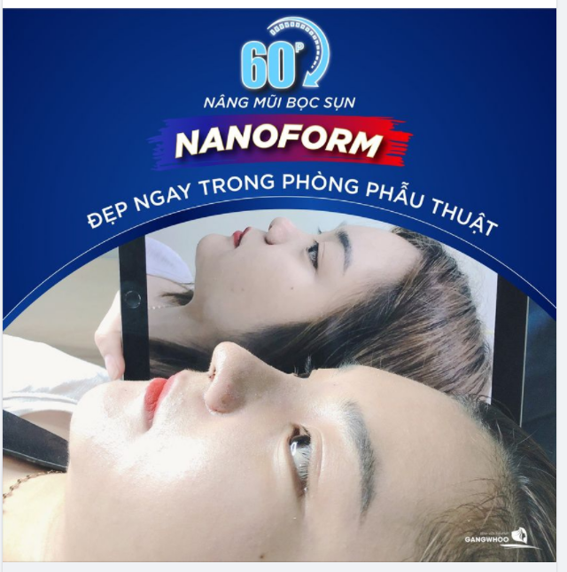 60 PHÚT THỰC HIỆN NÂNG MŨI (NANOFORM 4D) - ĐẸP NGAY TRONG PHÒNG PHẪU THUẬT