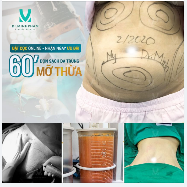 ​​​​​​​60 P ĐỔI THAY – CÓ NGAY BỤNG ĐẸP