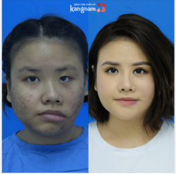 7 dịch vụ thẩm mỹ phức tạp - 3 ca đại phẫu khó khăn, Trần Thanh Hiền cùng ekip bác sĩ Kangnam cuối cùng đã thành công