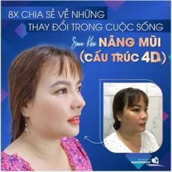 8X CHIA SẺ VỀ NHỮNG THAY ĐỔI TRONG CUỘC SỐNG SAU KHI NÂNG MŨI