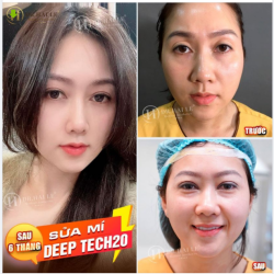 Add đã xem đi xem lại chiếc ảnh này, và rồi không biết viết caption gì...Chỉ biết rằng cô ấy thật là xinh đẹp và trẻ trung sau khi sửa mí!