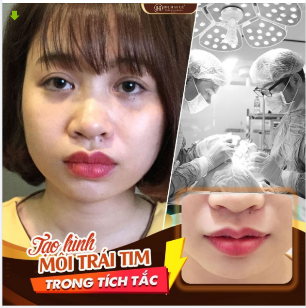 Ai like cho đôi môi ngọt ngào, quyến rũ của nàng ấy đi ạ.