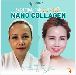 Ai rồi cũng bị "thâm sạm nám" thôi, nhưng bí thuật tái tạo làn da không tuổi như diễn viên Hoàng Yến thì không phải ai cũng biết