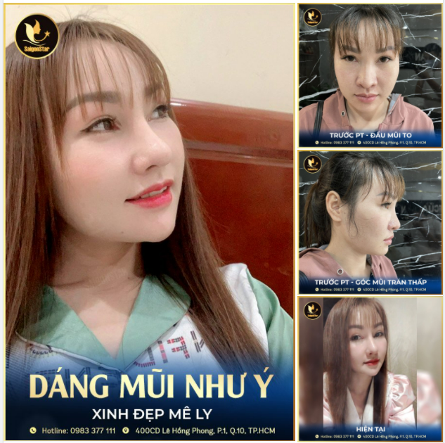 AI RỒI CŨNG SẼ KHÁC "Cứ nâng mũi là đẹp" quả không sai, chị Nhàng thay đổi ngoạn mục từ gương mặt kém sắc trở nên thần thái, sang chảnh hơn rất nhiều.