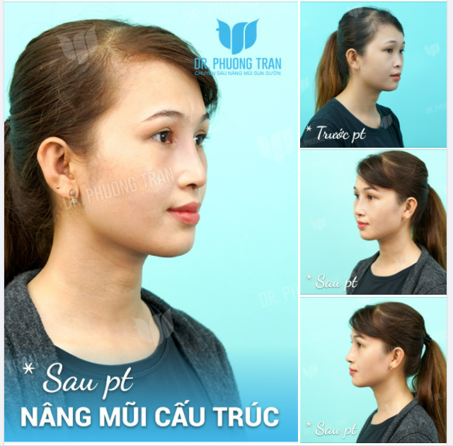 Anh muốn tìm một cô gái thú vị Thì em đây là một thí dụ