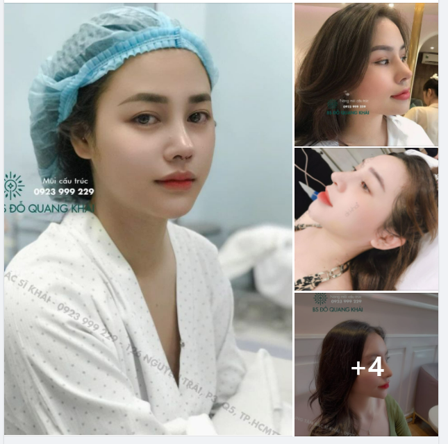 BÁC SĨ NÂNG DÁNG MŨI NÀO HỢP VỚI KHUÔN MẶT EM NHÉ!