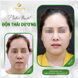Bạn có biết, khuôn mặt của con người sẽ dần biến đổi theo tính tình của một người.