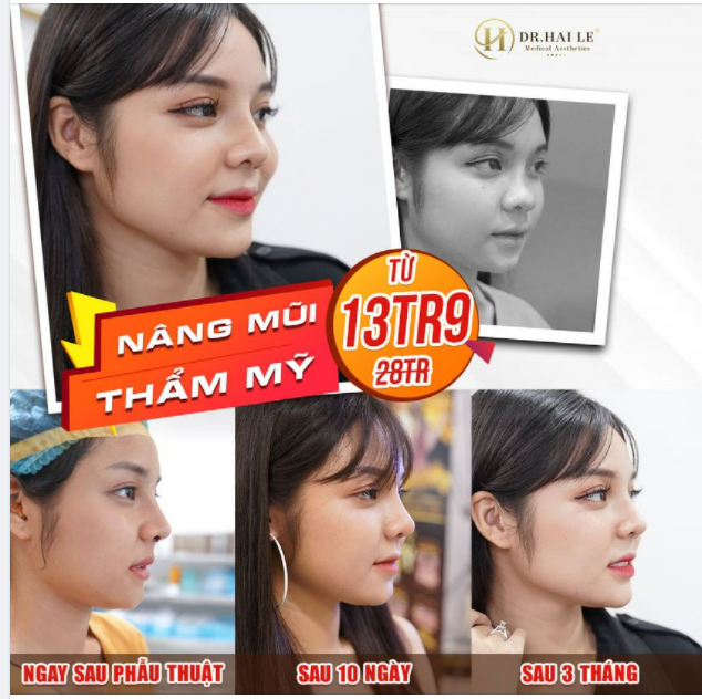 Bạn có mê mẩn dáng mũi này? ”Không có người phụ nữ xấu, chỉ có người phụ nữ chưa biết làm đẹp" đúng không ạ