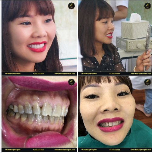 Bạn sẽ cảm thấy thế nào nếu bạn là cô gái này