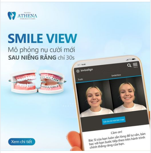 Bằng hình ảnh và thông tin mà bạn điền, các bác sĩ sẽ phân tích và lựa chọn cho bạn phương pháp Niềng răng hợp lý nhất với bạn.