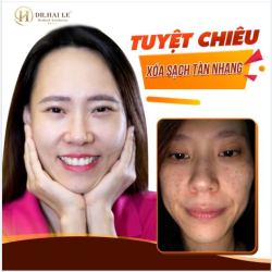 Bấy lâu nay người ta vẫn đồn: Hễ bị tàn nhang đến Dr.Hải Lê kiểu gì cũng khỏi, lại nhẹ nhàng vô cùng, điều khiến người ta mê mẩn nhất đó là hiệu quả duy trì cực kì dài lâu.