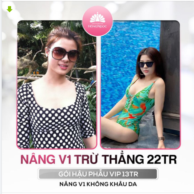 "BẺ LÁI" THÀNH CÔNG MẸ MƯỚP 2 CON HÓA HOT MOM SEXY SANG CHẢNH NHỜ NÂNG V1 DUAL PLANE