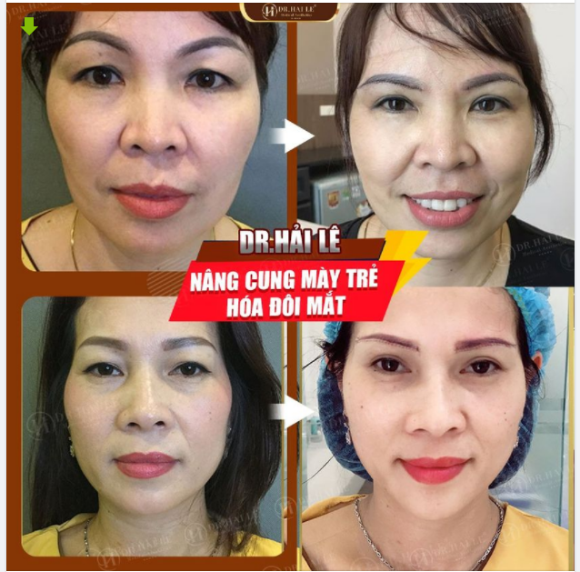 BÍ QUYẾT GIÚP ĐÔI MẮT "HỒI XUÂN"