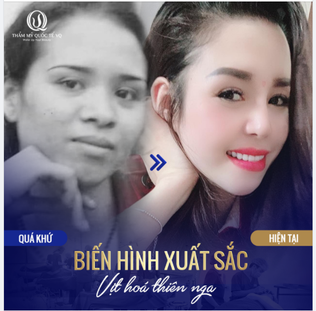 Biến hình xuất sắc khiến người ta ngĩ đập mặt đi xây lại