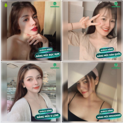 BỘ SƯU TẬP NHỮNG DÁNG MŨI ĐẸP TẠI BỆNH VIỆN