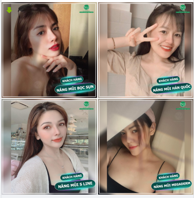 BỘ SƯU TẬP NHỮNG DÁNG MŨI ĐẸP TẠI BỆNH VIỆN