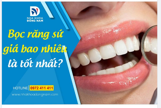 BỌC RĂNG SỨ GIÁ BAO NHIÊU LÀ TỐT NHẤT