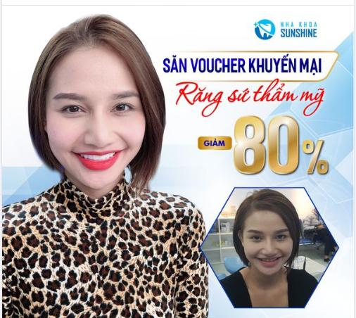 BỌC RĂNG SỨ GIÁ HỜI ĐẸP NGOÀI MONG ĐỢI